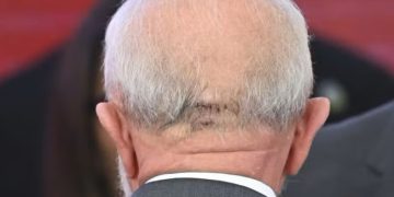 Lula é operado às pressas em São Paulo após sentir dor na cabeça